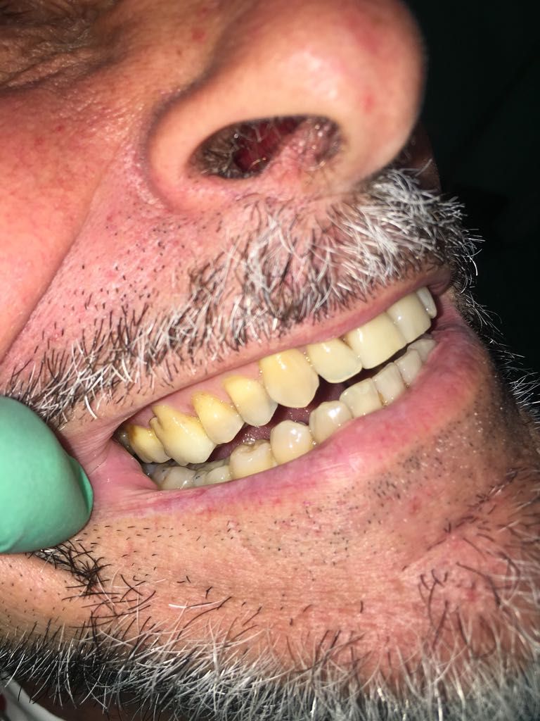 Stefano De Simone-112