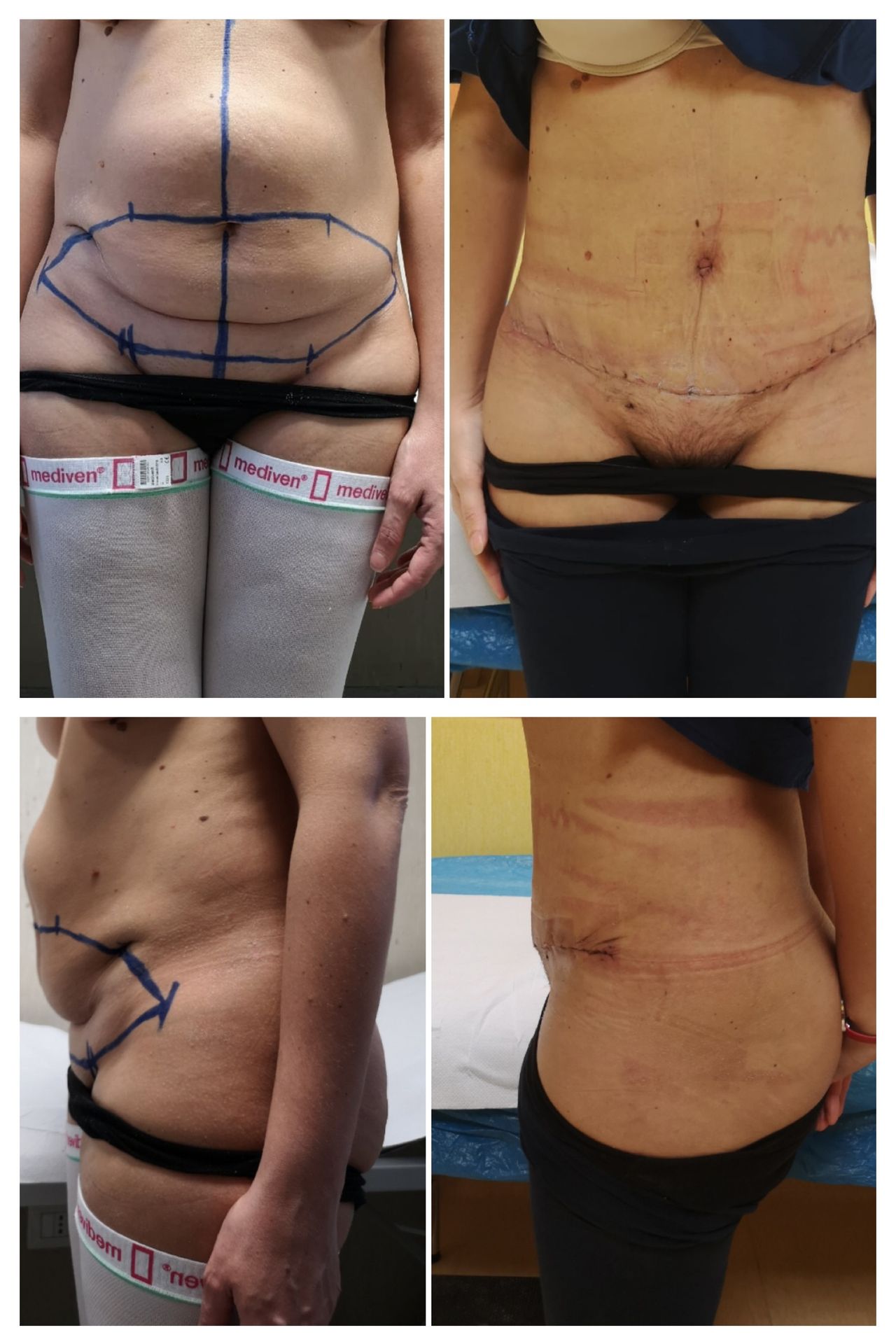 Antonio Ferronetti-8