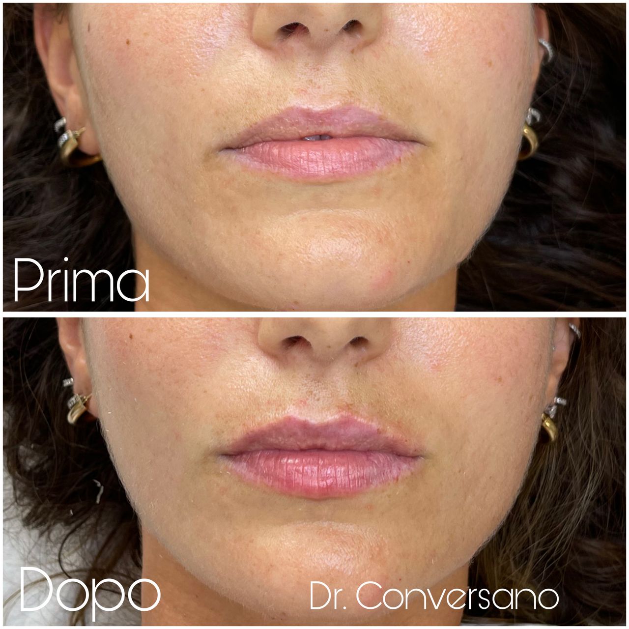 Sergio Conversano-28