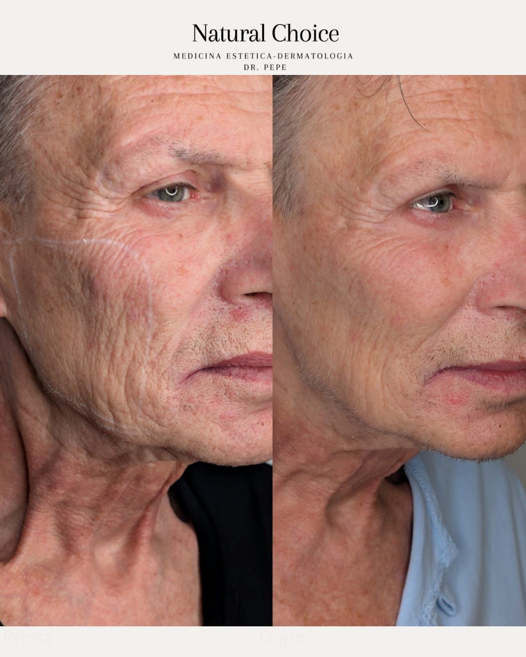 Francesco Maria Pepe-4