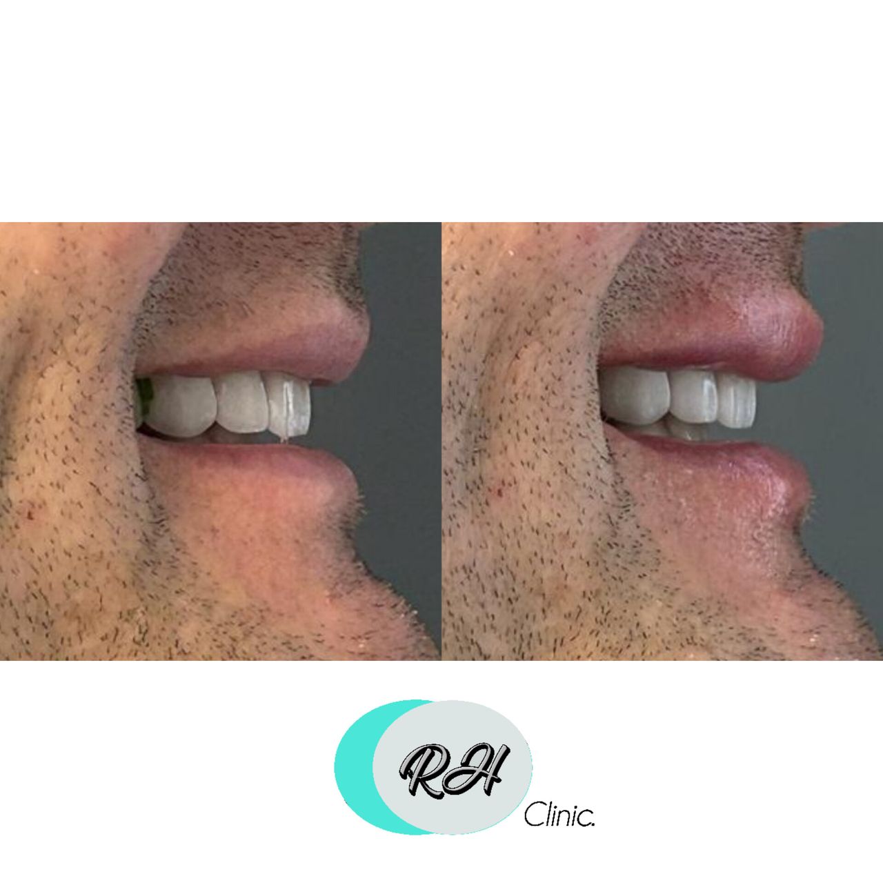 Rosalba Herrero Zerpa-111