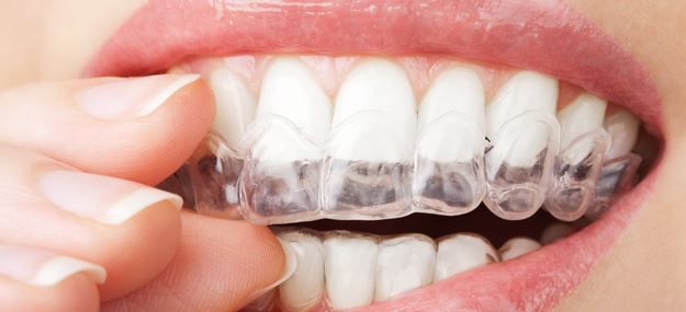 Riunito Ortodonzia Studio Dentistico De Giorgi-2