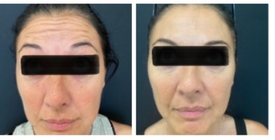 Silvia Melania Baio-7