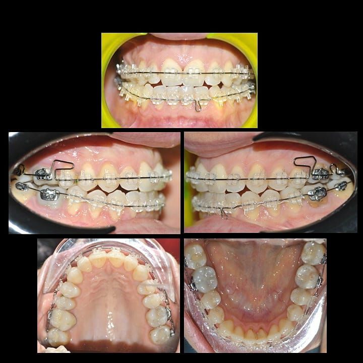 Gianluca Del Vecchio-41