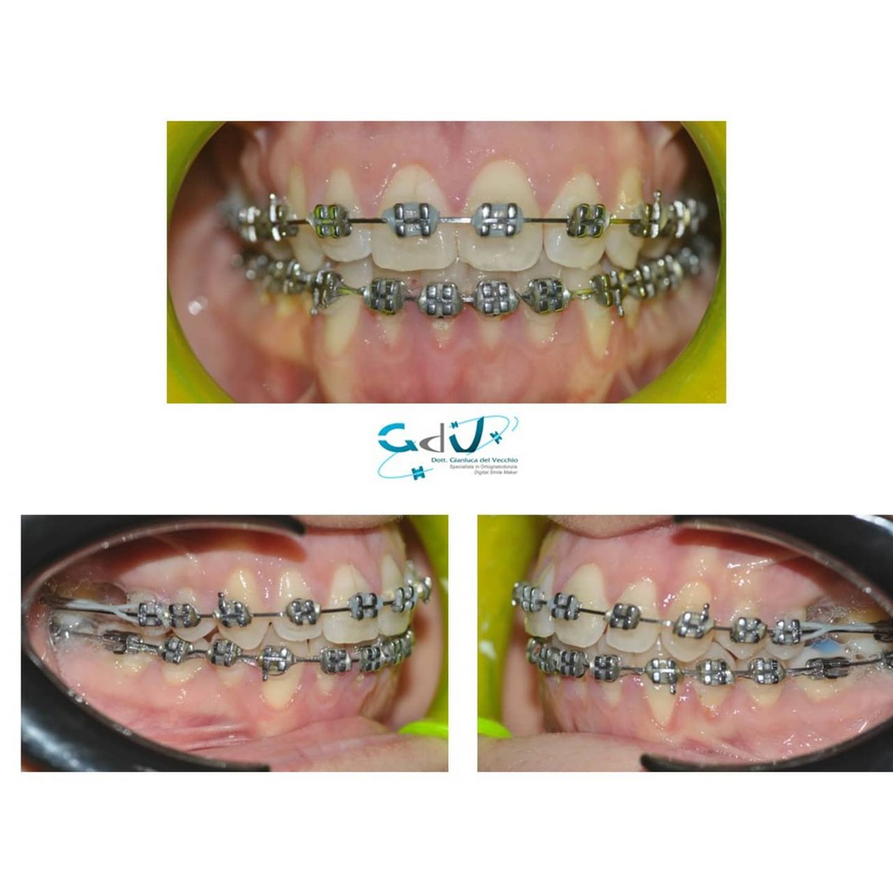 Gianluca Del Vecchio-102