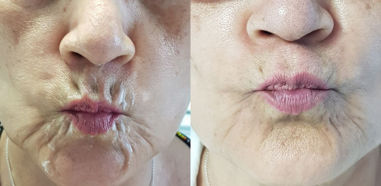 Rosalba Herrero Zerpa-472