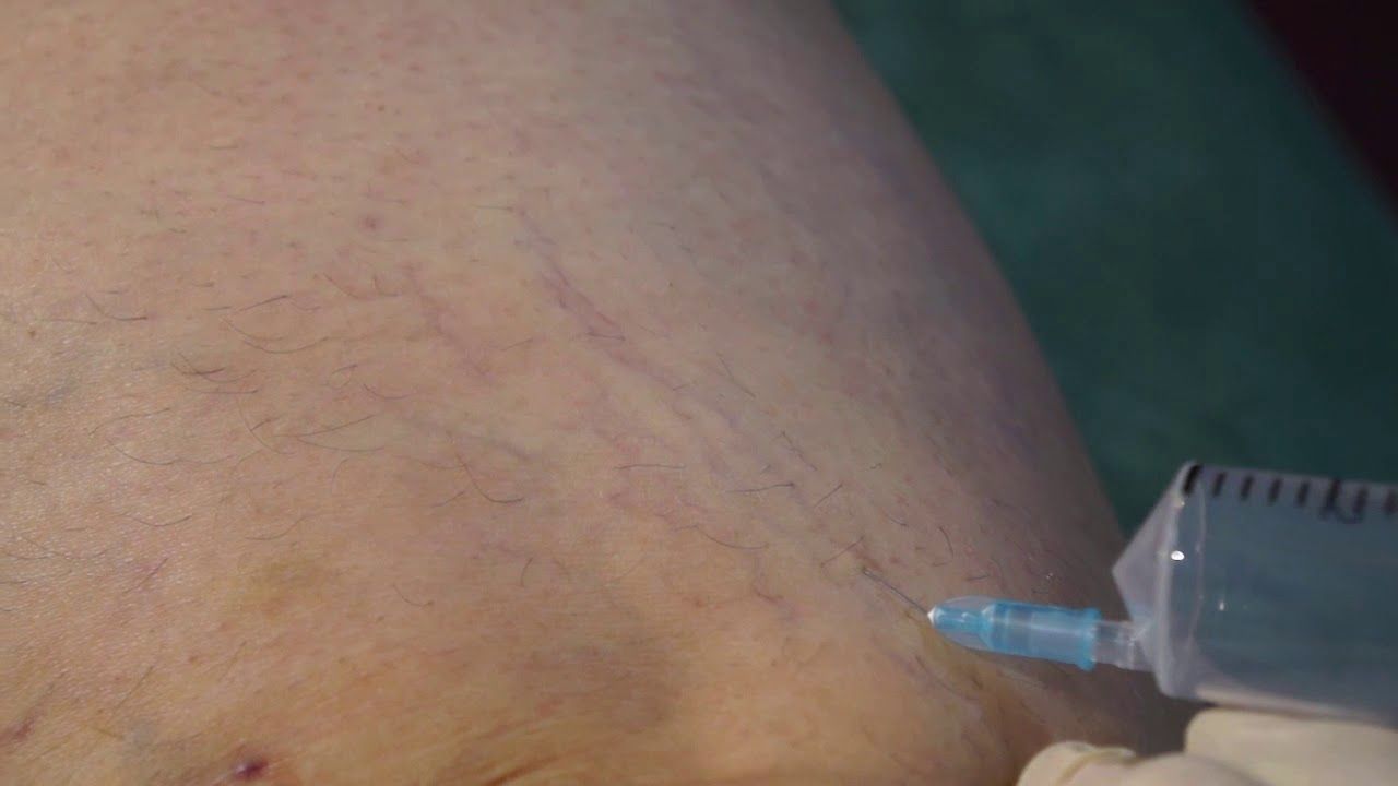 Edoardo Leonardo Rubattu-44