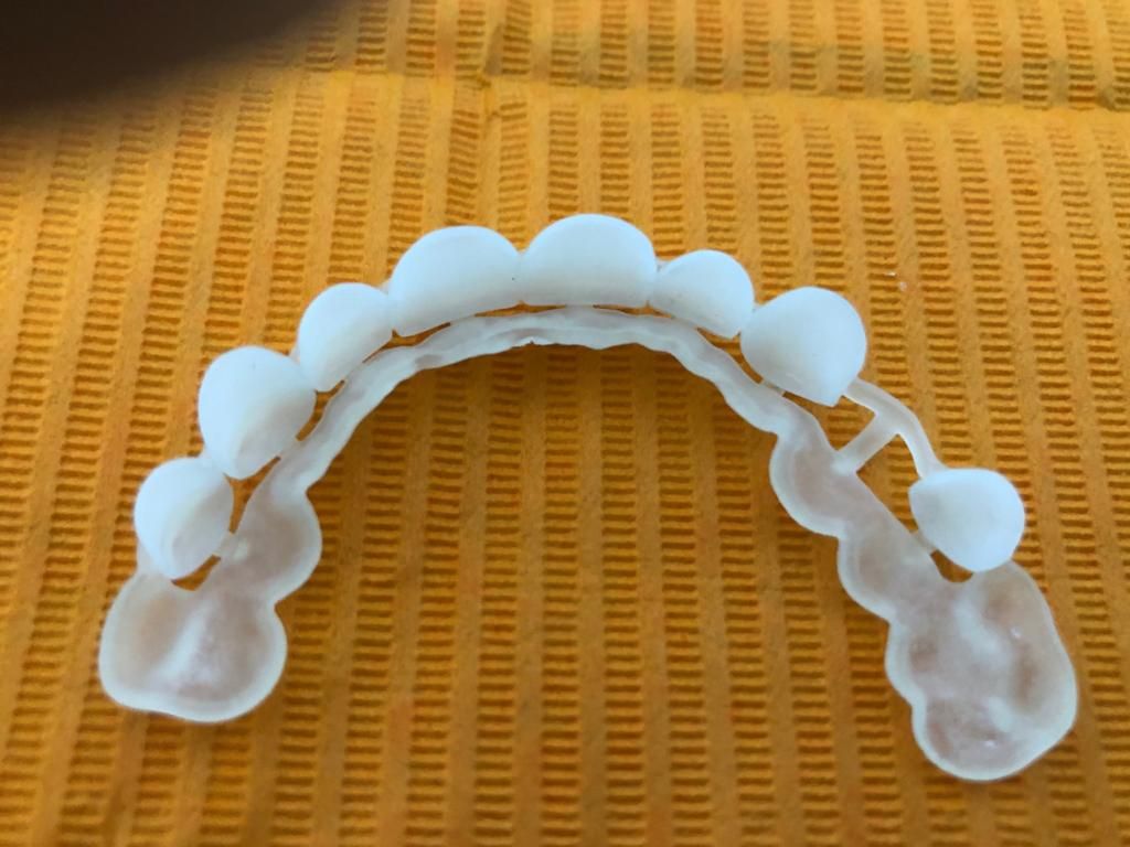 Ruben Patier Martin-36