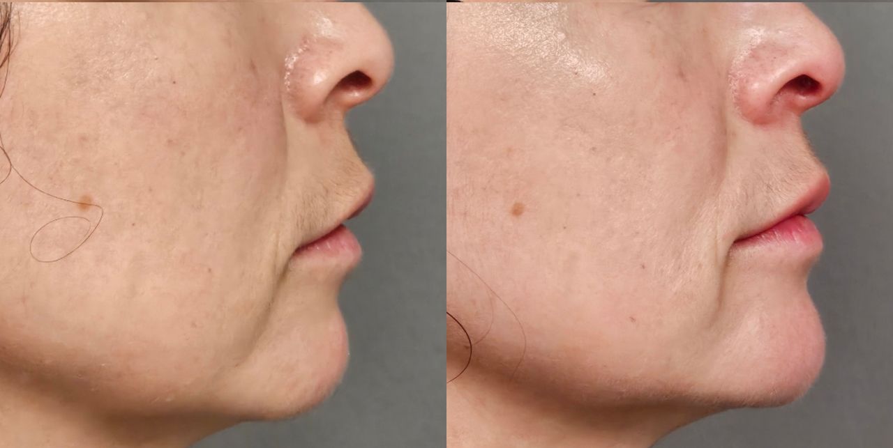 Rosalba Herrero Zerpa-448