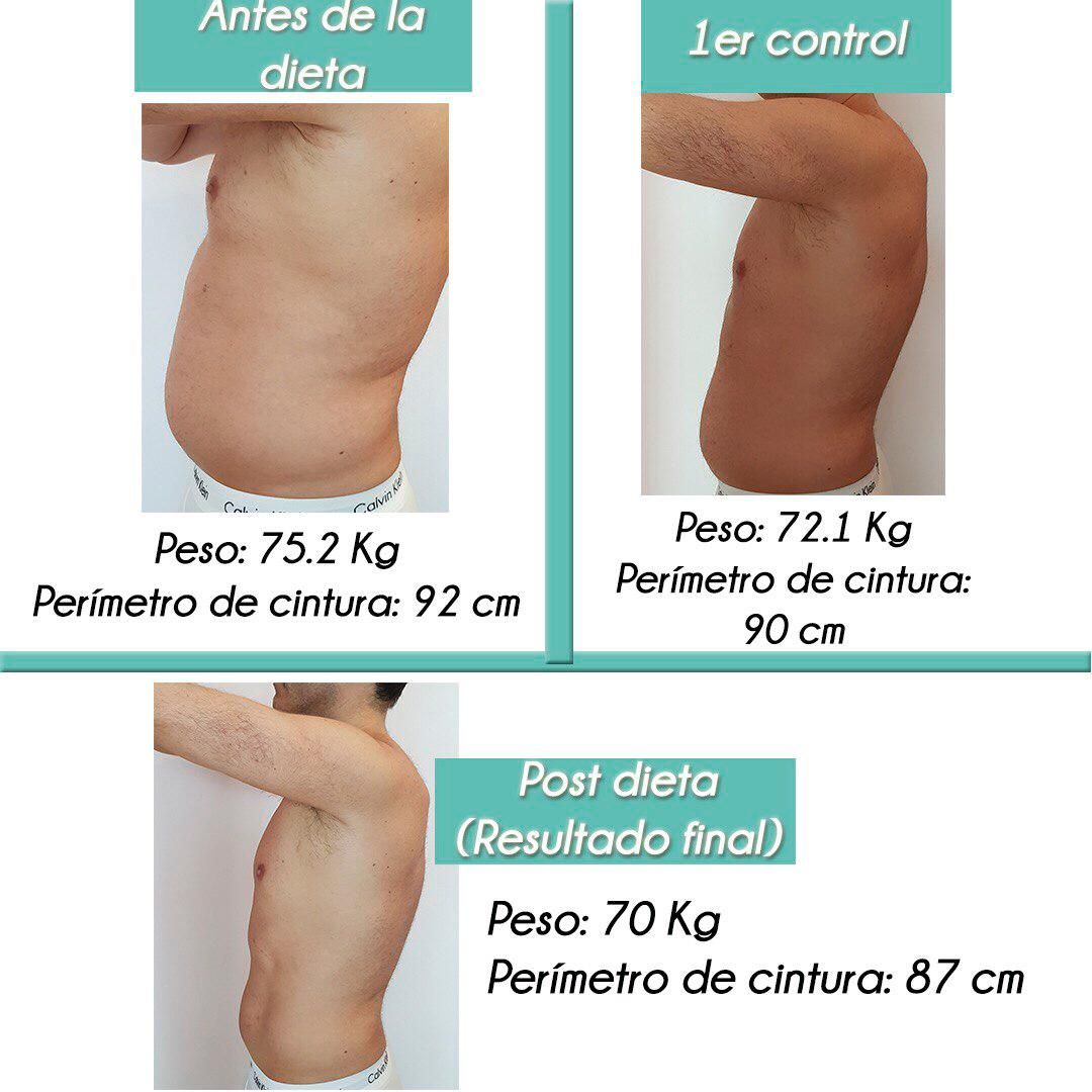 Rosalba Herrero Zerpa-329