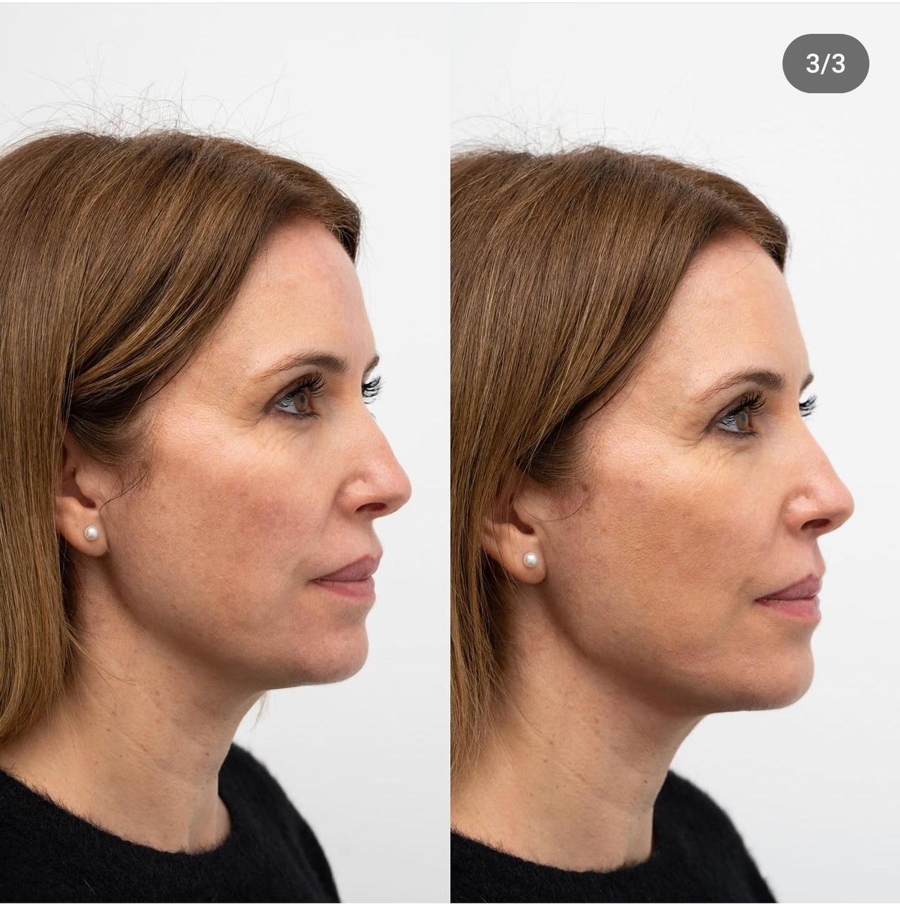 Raquel Moreno Pentinel-76