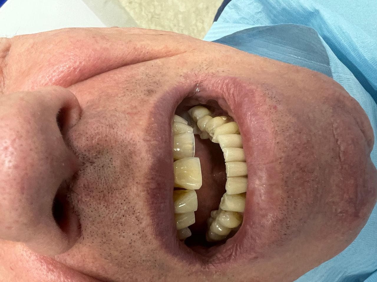 Luigi Aiardo Esposito-12