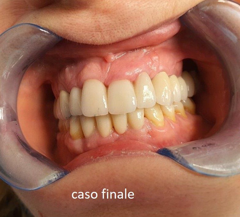 Michelina Borrelli-18