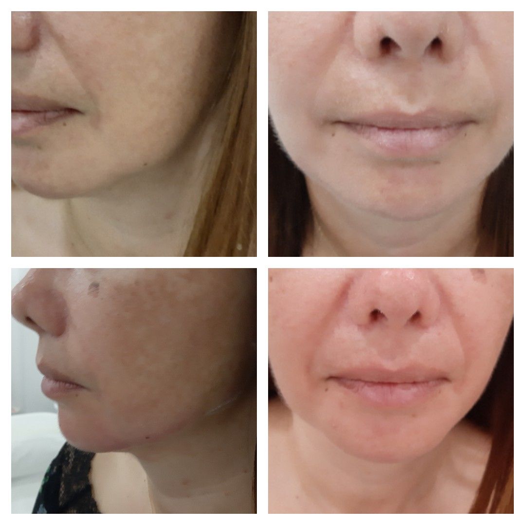 Paola Della Rocca-29