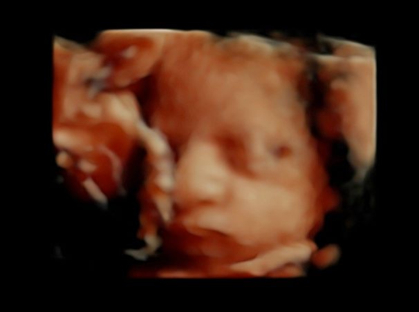 Tommaso Incandela-45