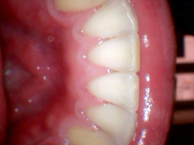 Michaela Houšková, Dis.et Dis.-4