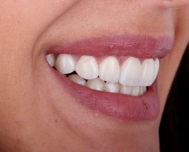 Pedro Antonio Fortuño Citoler-4