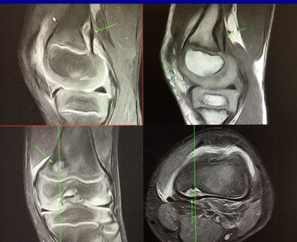 Cornelia Schröder-11