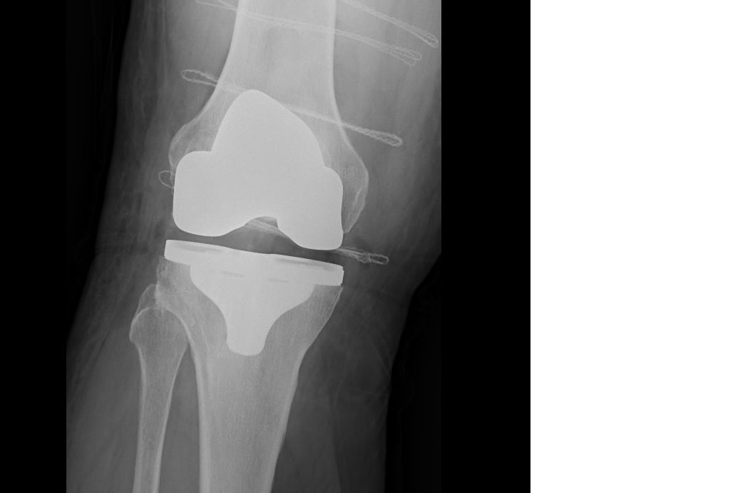 Mateusz Orzechowski-7