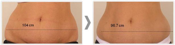 Anita Orzechowska-11