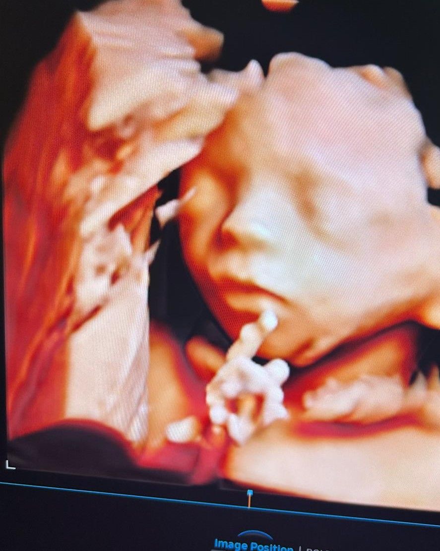 Annasole Chiarelli-1