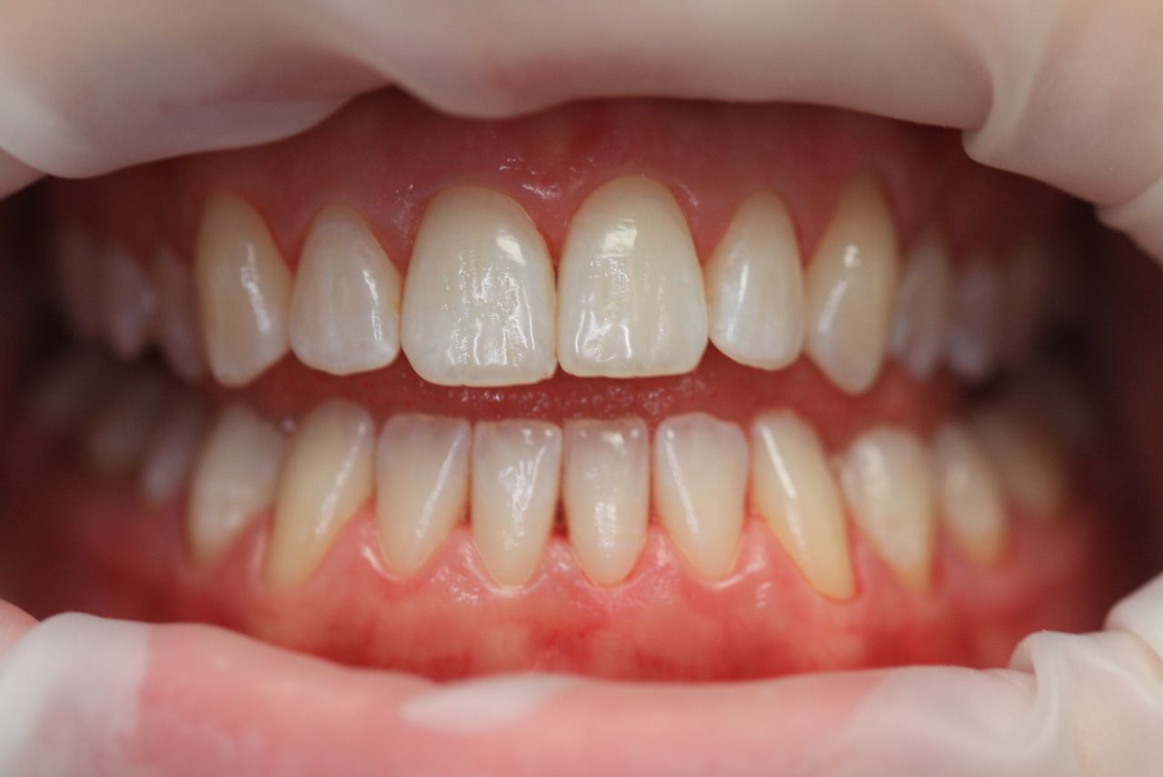 Paulina Sawicka-Soszyńska-27