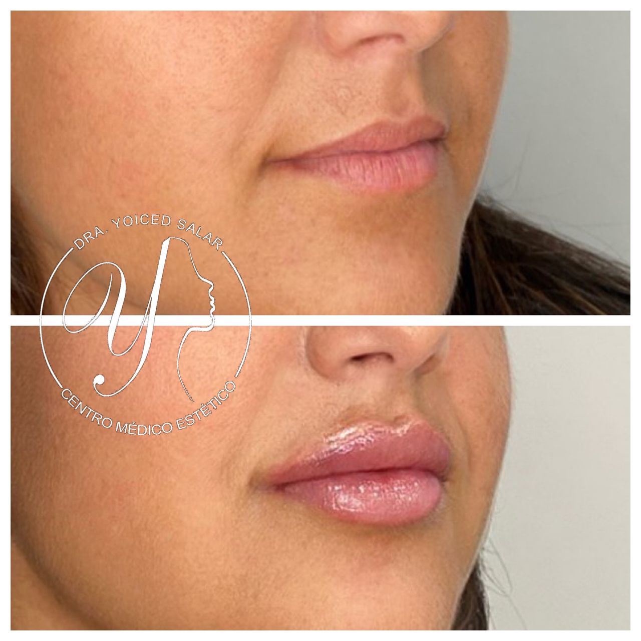 Yoiced Salar Peñate-17