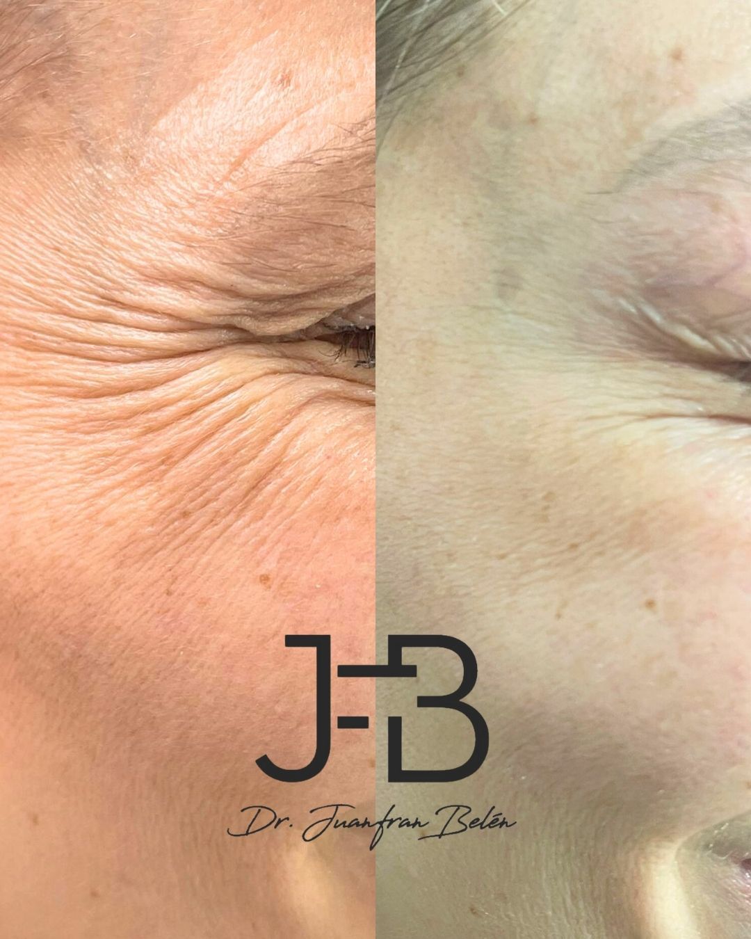 Juan Francisco Belén Montero-26