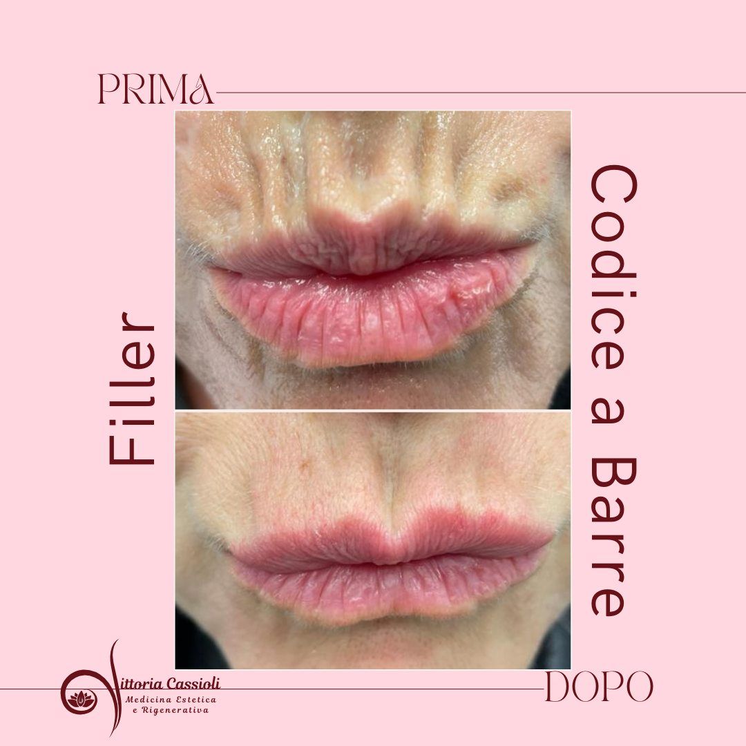 Vittoria Cassioli-34