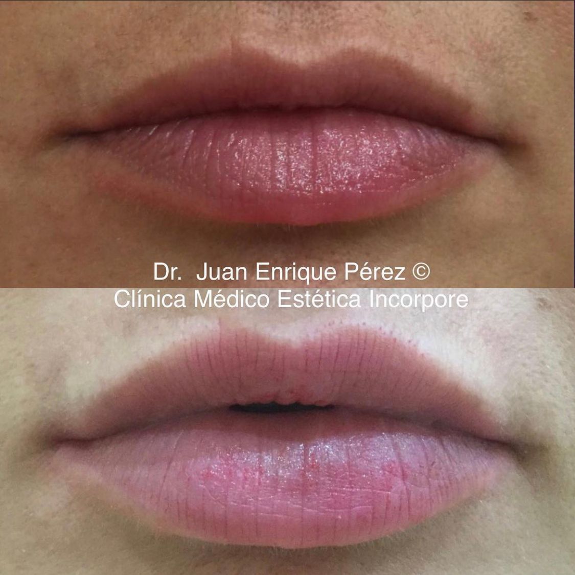 Juan Enrique Pérez Enríquez-23