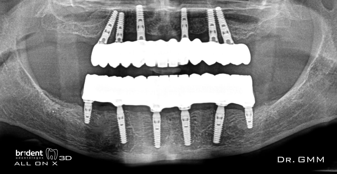Guillermo Moreno Masiá-85
