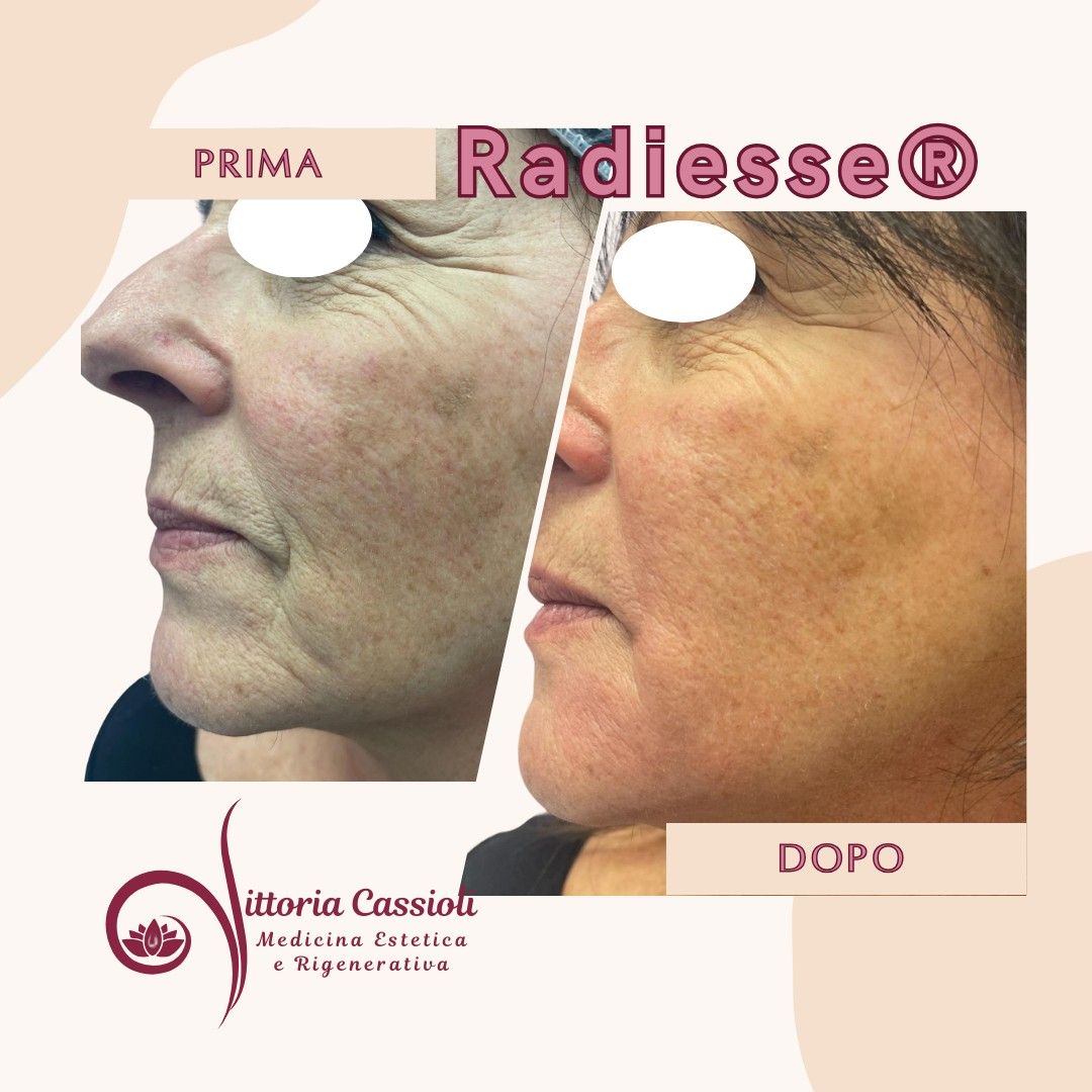 Vittoria Cassioli-37