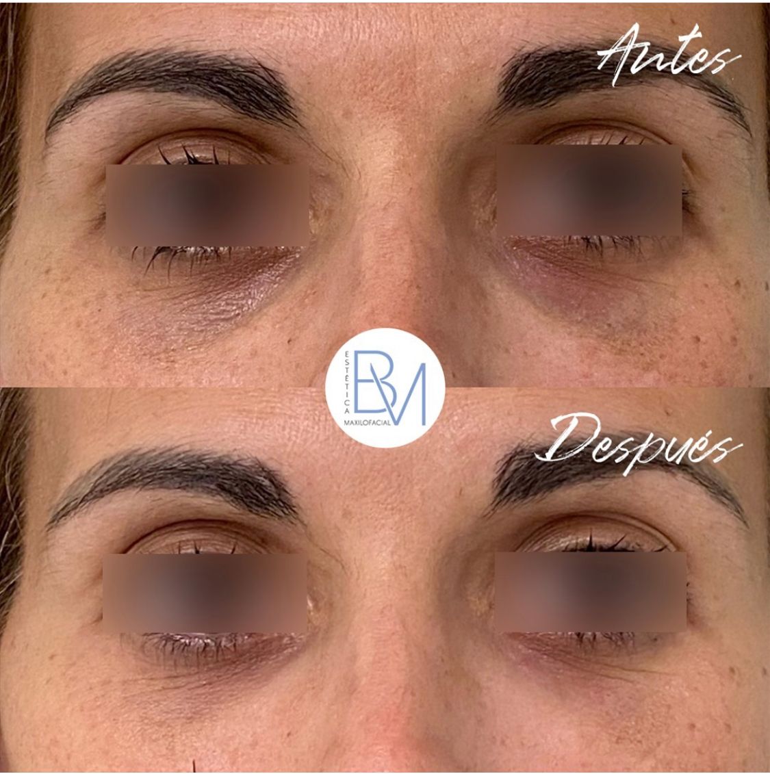 Beatriz Moralejo-108