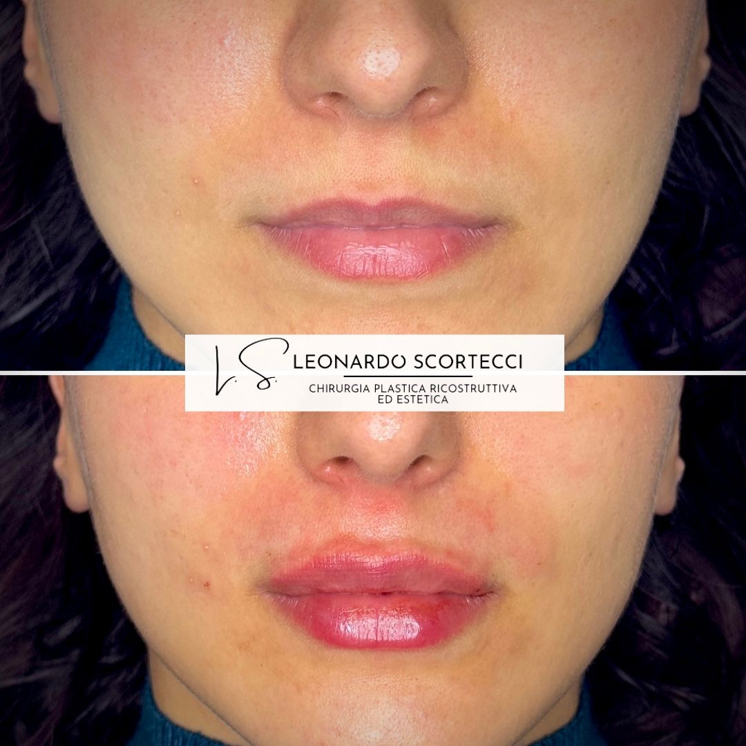 Leonardo Scortecci-9