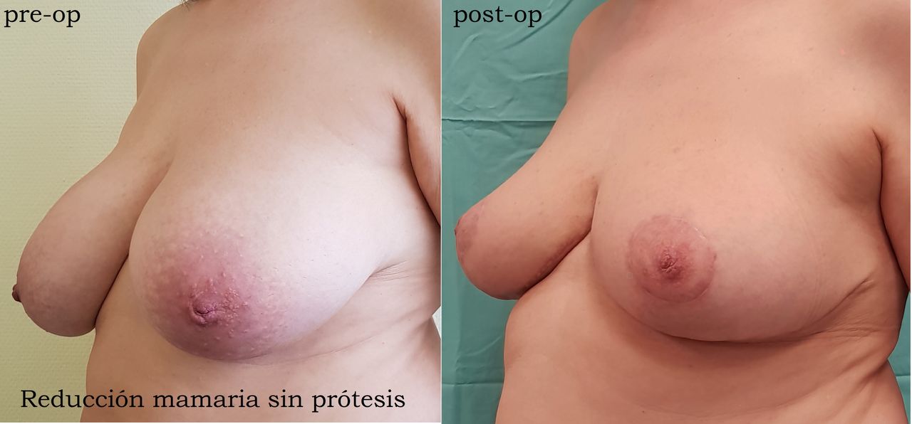 Enrique Bonanad Fernandez-7