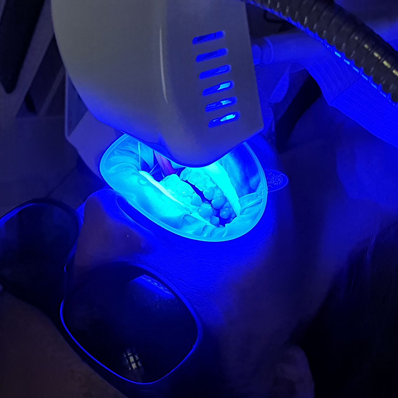 Francesco Anaclerico-14