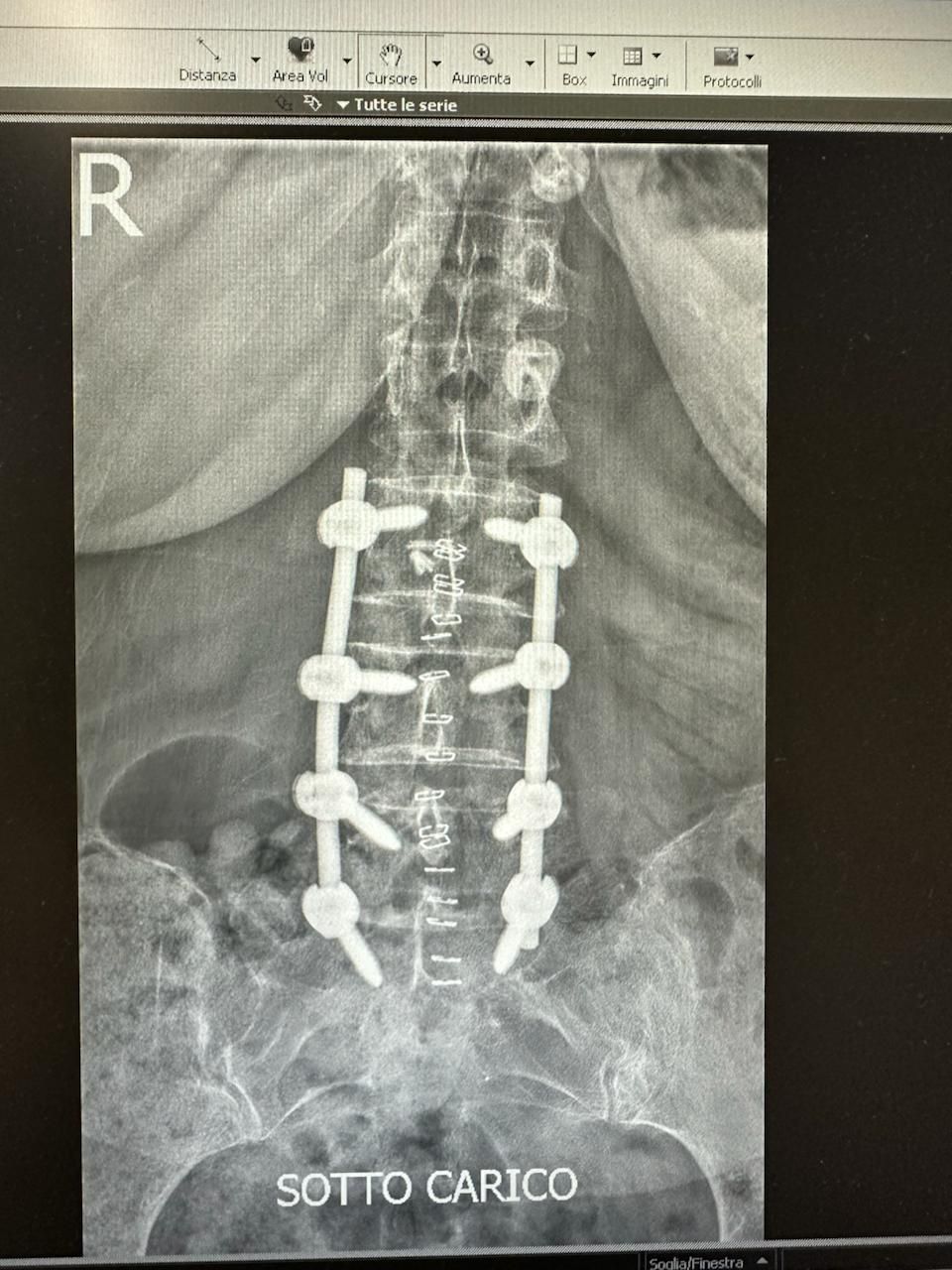 Valerio Cipolloni-33