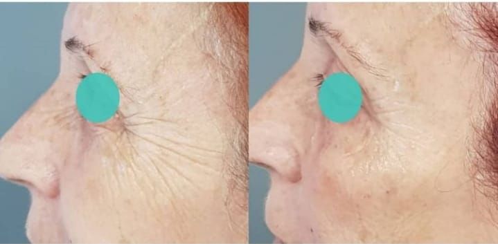 Rosalba Herrero Zerpa-478