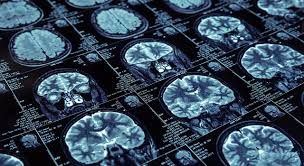 Javier Abril Jaramillo-16