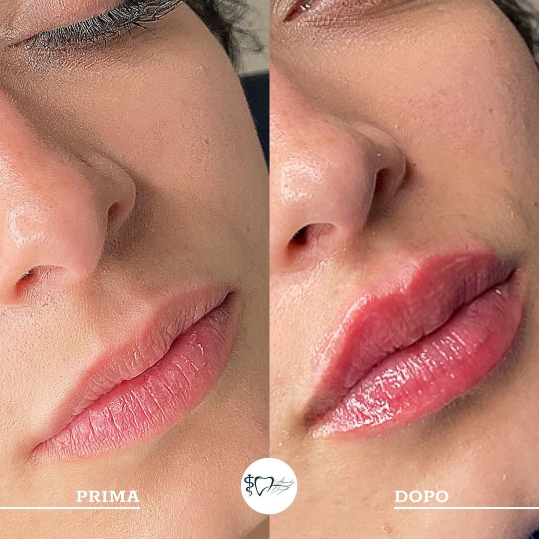 Alessandro Donzelli-4