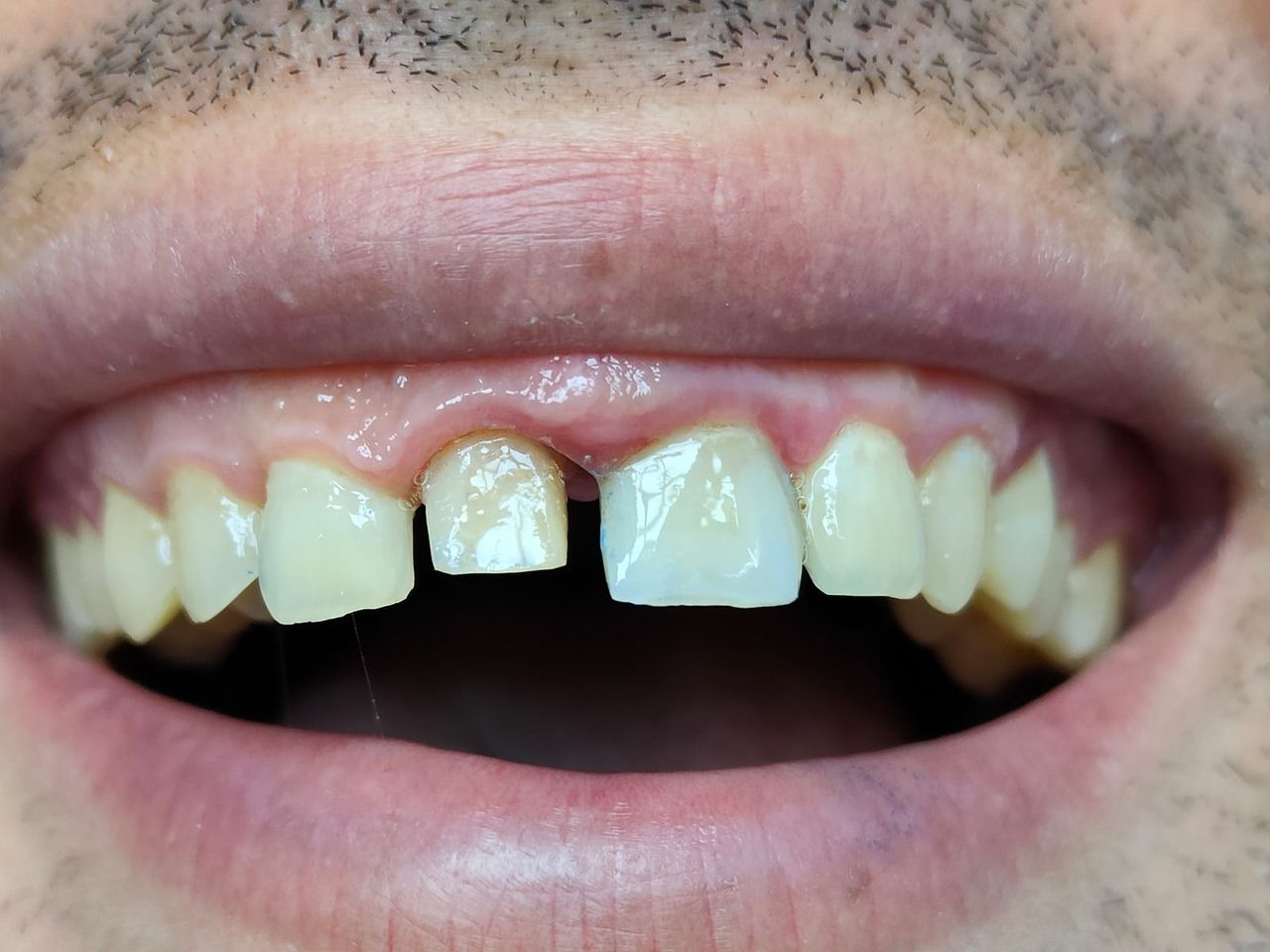 Stefano De Simone-122