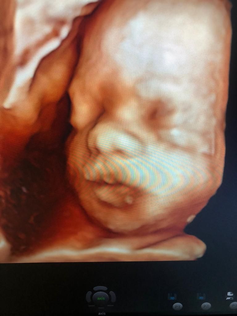 Dilek Turğut Kestane-7