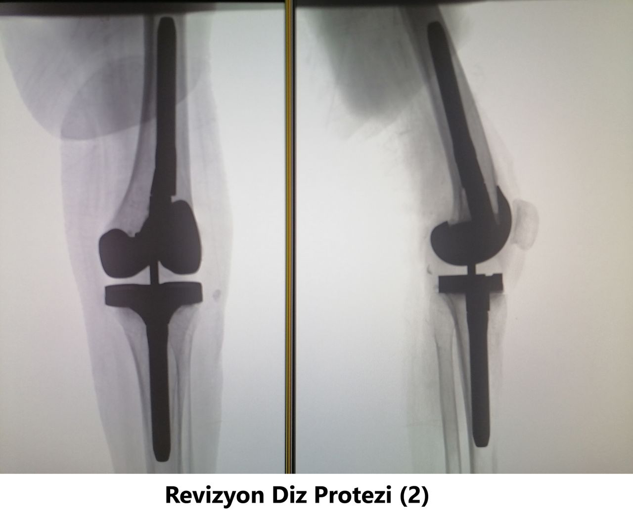 Javid M. Azarabadı-8