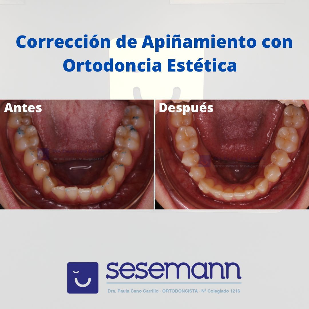 Paula Cano Carrillo-25