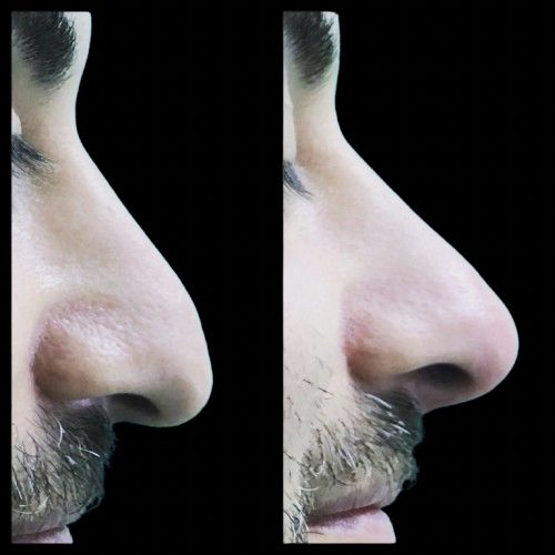 Giordano Vespasiani-34