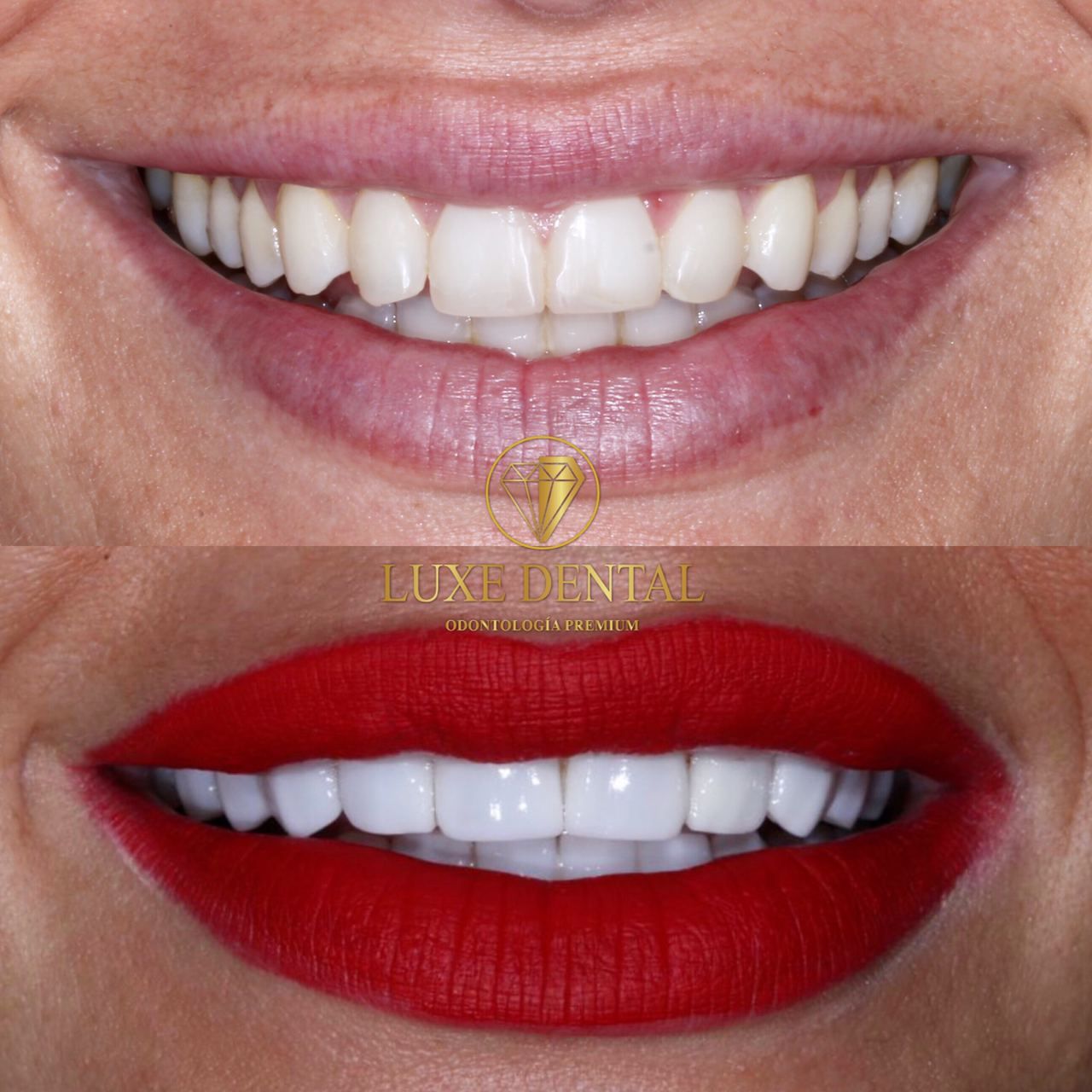 Ruben Patier Martin-7