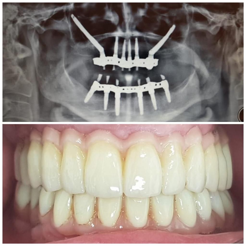 Paula Cano Carrillo-112
