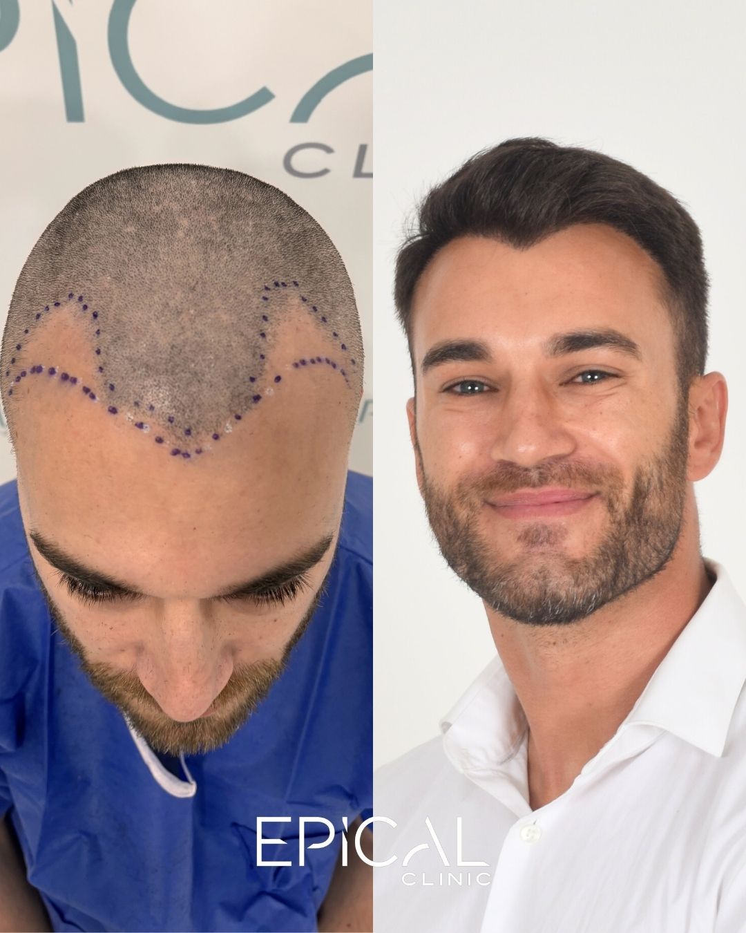 Juan Francisco Belén Montero-3