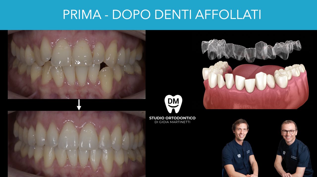 Francesco Martinetti-11