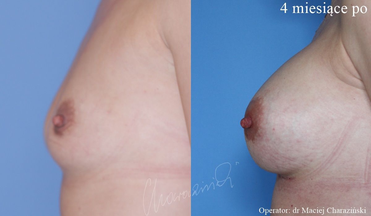 Maciej Charaziński-124